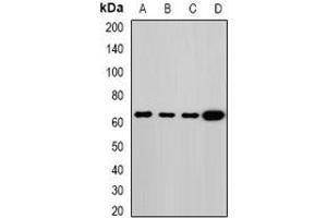 Western blot analysis of Melanophilin expression in MCF7 (A), HT29 (B), mouse lung (C), rat lung (D) whole cell lysates. (Melanophilin anticorps)