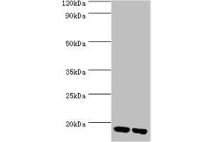 Western blot All lanes: Peptidyl-prolyl cis-trans isomerase FKBP2 antibody at 10 μg/mL Lane 1: Mouse thymus tissue Lane 2: Rat brain tissue Secondary Goat polyclonal to rabbit IgG at 1/10000 dilution Predicted band size: 16 kDa Observed band size: 16 kDa (FKBP2 anticorps  (AA 22-142))