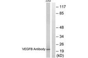 Western blot analysis of extracts from Jurkat cells, using VEGFB Antibody. (VEGFB anticorps  (AA 91-140))