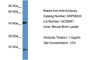 Western Blotting (WB) image for anti-ADP-Ribosylation Factor 4 (ARF4) (N-Term) antibody (ABIN785783) (ARF4 anticorps  (N-Term))