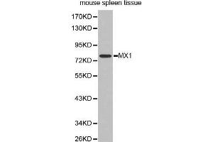 Western Blotting (WB) image for anti-Myxovirus Resistance Protein 1 (MX1) (AA 368-662) antibody (ABIN3022533) (MX1 anticorps  (AA 368-662))