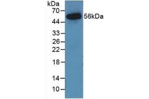 Detection of Recombinant AGT, Rat using Monoclonal Antibody to Angiotensinogen (AGT) (AGT anticorps  (AA 25-477))