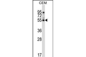 LMD Antibody (N-term) (ABIN657125 and ABIN2846269) western blot analysis in CEM cell line lysates (35 μg/lane). (PALMD anticorps  (N-Term))