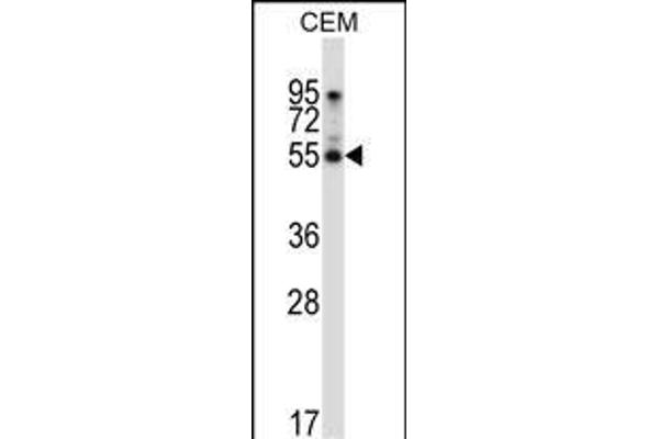 PALMD anticorps  (N-Term)