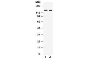 Western blot testing of 1) rat liver and 2) mouse liver lysate with RIP140 antibody. (NRIP1 anticorps)
