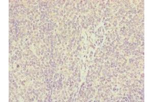 Immunohistochemistry of paraffin-embedded human tonsil tissue using ABIN7156903 at dilution of 1:100 (IL36A/IL1F6 anticorps  (AA 1-158))