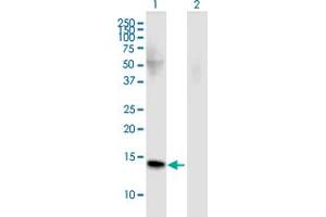 Western Blot analysis of FMN2 expression in transfected 293T cell line by FMN2 monoclonal antibody (M02), clone 4B8.