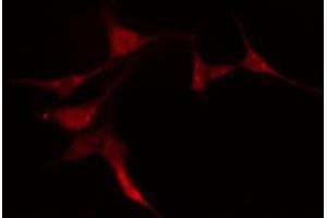 ABIN6274200 staining COLO205 cells by IF/ICC.