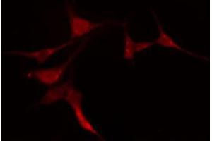 ABIN6274200 staining COLO205 cells by IF/ICC. (PRKACG anticorps)