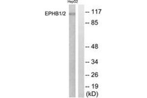 Western blot analysis of extracts from HepG2 cells, using EPHB1/2 (Ab-594/604) Antibody. (EPHB1/2 anticorps  (AA 561-610))