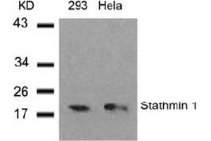 Image no. 3 for anti-Stathmin 1 (STMN1) (Ser37) antibody (ABIN197456) (Stathmin 1 anticorps  (Ser37))