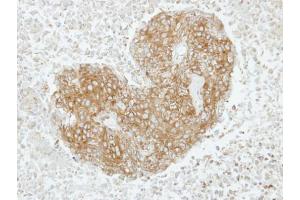 IHC-P Image Immunohistochemical analysis of paraffin-embedded SAS xenograft, using GABARAPL2, antibody at 1:100 dilution.