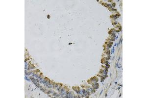 Immunohistochemistry of paraffin-embedded mouse lung using EFNA1 Antibody (ABIN5973078) at dilution of 1/100 (40x lens).