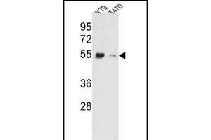 Western blot analysis of EEF1A1/ EEF1A2 Antibody (N-term) (ABIN390520 and ABIN2840872) in Y79, T47D cell line lysates (35 μg/lane). (EEF1A2 anticorps  (AA 46-72))
