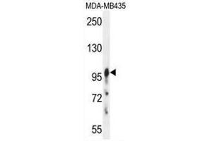 AXIN1 Antibody (C-term) western blot analysis in MDA-MB435 cell line lysates (35µg/lane). (Axin anticorps  (C-Term))