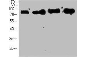 Western Blot analysis of customer's using p63 Polyclonal Antibody. (p63 anticorps  (N-Term))
