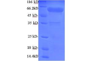 SDS-PAGE (SDS) image for AarF Domain Containing Kinase 2 (ADCK2) (AA 200-609) protein (His tag) (ABIN5714400)