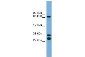 WB Suggested Anti-DNAI2  Antibody Titration: 0. (DNAI2 anticorps  (N-Term))