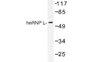 Image no. 1 for anti-Heterogeneous Nuclear Ribonucleoprotein L (HNRNPL) antibody (ABIN272168) (HNRNPL anticorps)