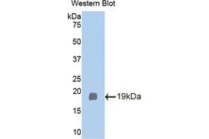 Detection of Recombinant Klb, Mouse using Polyclonal Antibody to Klotho Beta (KLb) (Klotho beta anticorps  (AA 380-506))