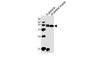 All lanes : Anti-DLK1 Antibody (C-term) at 1:1000 dilution Lane 1: human placenta lysates Lane 2: mouse skeletal muscle lysates Lysates/proteins at 20 μg per lane.
