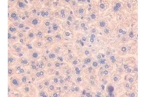 Detection of ATF7 in Mouse Liver Tissue using Polyclonal Antibody to Activating Transcription Factor 7 (ATF7)