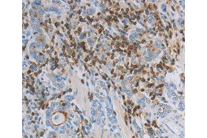 Immunohistochemistry (IHC) image for anti-Par-6 Partitioning Defective 6 Homolog alpha (PARD6A) antibody (ABIN1874031) (PARD6A anticorps)