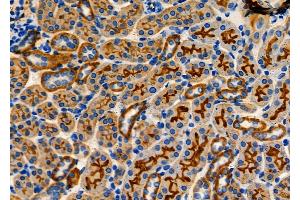 ABIN6260462 and ABIN6278357 at 1/100 staining Mouse kidney tissue by IHC-P. (CARD9 anticorps  (C-Term))