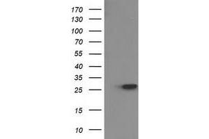 Western Blotting (WB) image for anti-Hydroxyprostaglandin Dehydrogenase 15-(NAD) (HPGD) antibody (ABIN1496362) (HPGD anticorps)