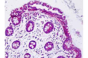 Anti-MNSOD / SOD2 antibody IHC staining of human colon. (SOD2 anticorps)