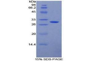Fc gamma RII (CD32) (AA 69-309) protein (His tag,T7 tag)