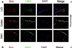 The relationships of the Wnt and Notch signaling pathway and the proliferation of epidermal stem cells was analyzed by immunofluorescence. (c-MYC anticorps  (AA 101-200))