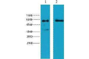 Western Blotting (WB) image for anti-Keratin 6 (KRT6) antibody (ABIN3178633) (Keratin 6 anticorps)