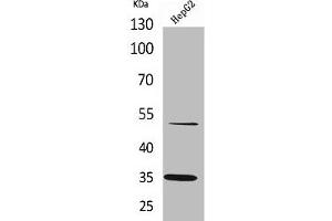 Western Blot analysis of HepG2 cells using TFPI Polyclonal Antibody