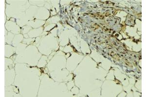 ABIN6278791 at 1/100 staining Human lung tissue by IHC-P. (MBIP anticorps  (Internal Region))