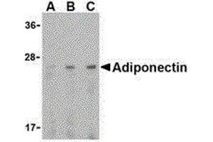Western Blotting (WB) image for anti-Adiponectin (ADIPOQ) (C-Term) antibody (ABIN2477286)