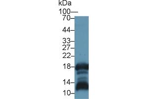 Detection of GKN1 in Rat Stomach lysate using Polyclonal Antibody to Gastrokine 1 (GKN1) (Gastrokine 1 anticorps  (AA 27-151))