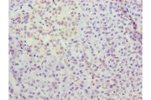 Immunohistochemistry of paraffin-embedded human pancreatic tissue using ABIN7159667 at dilution of 1:100 (METTL25 anticorps  (AA 206-455))