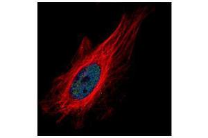 ICC/IF Image Confocal immunofluorescence analysis (Olympus FV10i) of paraformaldehyde-fixed HeLa, using ZNF449, antibody (Green) at 1:500 dilution.
