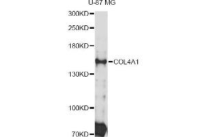 Western blot analysis of extracts of U-87 MG cells, using COL4A1 Antibody (ABIN4903336) at 1:3000 dilution. (COL4A1 anticorps)