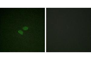 Peptide - +Immunofluorescence analysis of HeLa cells, using CDC16/APC6 (Ab-560) antibody. (CDC16 anticorps  (Ser560))