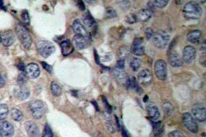 Image no. 1 for anti-Heat Shock 27kDa Protein 1 (HSPB1) antibody (ABIN265470) (HSP27 anticorps)
