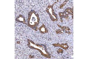 IHC analysis of TOMM34 using anti-TOMM34 antibody (ABIN7599253). (TOMM34 anticorps  (AA 1-309))