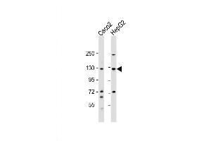 Western Blot at 1:1000 dilution Lane 1: Caco2 whole cell lysate Lane 2: HepG2 whole cell lysate Lysates/proteins at 20 ug per lane. (UBE4A anticorps  (AA 451-479))