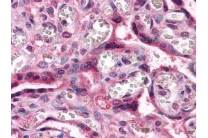 Immunohistochemical analysis of paraffin-embedded human Placenta tissues using CTNNB1 mouse mAb