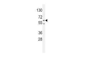 PRK (Thr172) Antibody (ABIN654800 and ABIN2844475) western blot analysis in K562 cell line lysates (35 μg/lane).
