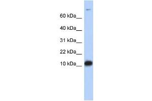 WB Suggested Anti-FABP3 Antibody Titration:  0. (FABP3 anticorps  (Middle Region))