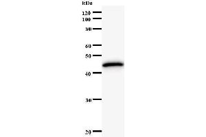 Western Blotting (WB) image for anti-K(lysine) Acetyltransferase 5 (KAT5) antibody (ABIN931130) (KAT5 anticorps)
