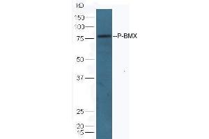 Lane 1: mouse lung lysates Lane 2: mouse kidney lysates probed with Anti-BMX (Tyr566) Polyclonal Antibody, Unconjugated  at 1:5000 90min in 37˚C. (BMX anticorps  (pTyr566))