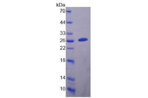 Image no. 1 for Dihydropyrimidinase-Like 5 (DPYSL5) (AA 1-205) protein (His tag) (ABIN6239564)